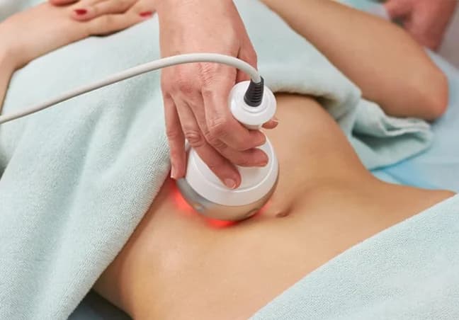 Cavitation 360 & radio frequency